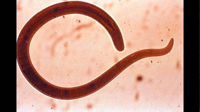 Trihinela