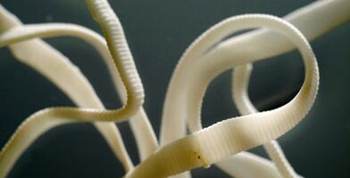 stan parazit iz ljudskog tijela